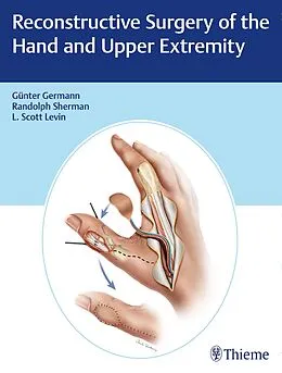 E-Book (pdf) Reconstructive Surgery of the Hand and Upper Extremity von Günter Germann, L. Scott Levin, Randolph Sherman