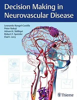 E-Book (pdf) Decision Making in Neurovascular Disease von Leonardo Rangel-Castilla, Peter Nakaji, Adnan H. Siddiqui