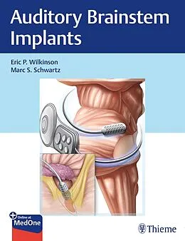 E-Book (pdf) Auditory Brainstem Implants von Eric P. Wilkinson, Marc S. Schwartz