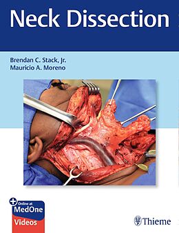 E-Book (pdf) Neck Dissection von Jr. Brendan C. Stack, Mauricio A. Moreno