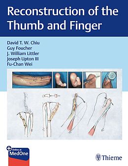 eBook (pdf) Reconstruction of the Thumb and Finger de 