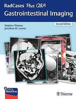 E-Book (pdf) RadCases Plus Q&A Gastrointestinal Imaging von Stephen Thomas, Jonathan M. Lorenz