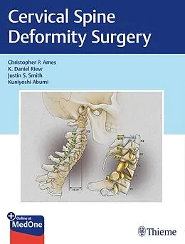 E-Book (pdf) Cervical Spine Deformity Surgery von Christopher P. Ames, K. Daniel Riew, Justin S. Smith