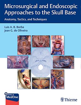  Microsurgical and Endoscopic Approaches to the Skull Base de Luis Borba, Jean de Oliveira