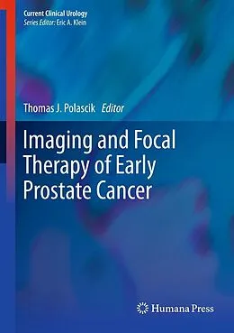 E-Book (pdf) Imaging and Focal Therapy of Early Prostate Cancer von Thomas J. Polascik