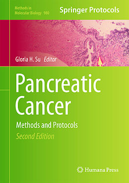 Livre Relié Pancreatic Cancer de 