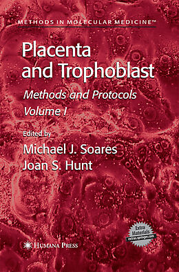Couverture cartonnée Placenta and Trophoblast de 