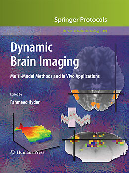 Kartonierter Einband Dynamic Brain Imaging von 