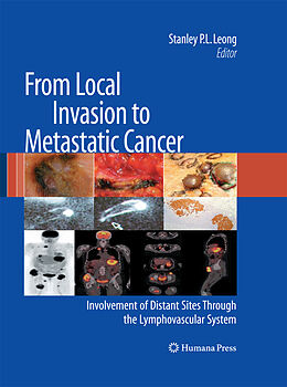 Kartonierter Einband From Local Invasion to Metastatic Cancer von 