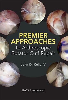 Kartonierter Einband Premier Approaches to Arthroscopic Rotator Cuff Repair von John Kelly