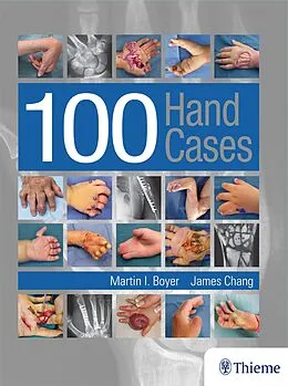 E-Book (epub) 100 Hand Cases von Martin Boyer, James Chang