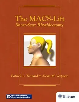 E-Book (epub) The MACS-Lift von Patrick Tonnard, Alexis Verpaele