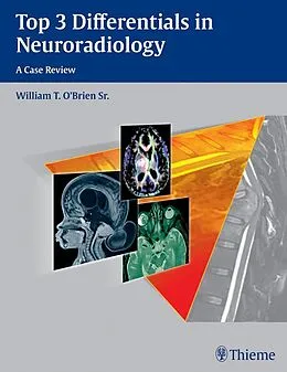 E-Book (epub) Top 3 Differentials in Neuroradiology von William T. O'Brien