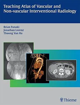 E-Book (epub) Teaching Atlas of Vascular and Non-vascular Interventional Radiology von Brian Funaki, Jonathan M. Lorenz, Thuong G. van Ha