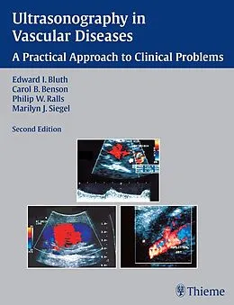 E-Book (epub) Ultrasonography in Vascular Diseases von Edward I. Bluth, Carol B. Benson, Philip W. Ralls