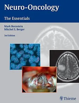 E-Book (epub) Neuro-Oncology: The Essentials von 