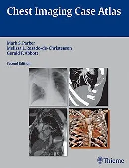 E-Book (epub) Chest Imaging Case Atlas von Mark S. Parker, Melissa L. Rosado-De-Christenson, Gerald F. Abbott