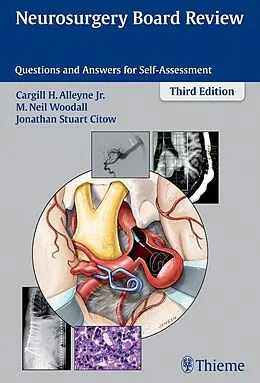 E-Book (epub) Neurosurgery Board Review von 