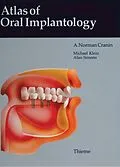 E-Book (epub) Atlas of Oral Implantology von A. Norman Cranin, Michael Klein