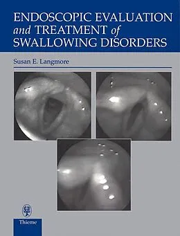 E-Book (epub) Endoscopic Evaluation and Treatment of Swallowing Disorders von Susan Langmore