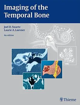 E-Book (epub) Imaging of the Temporal Bone von Joel D. Swartz, Laurie A. Loevner