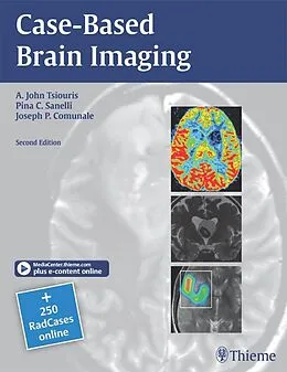 E-Book (epub) Case-Based Brain Imaging von A. John Tsiouris, Pina C. Sanelli, Joseph Comunale
