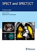 E-Book (epub) SPECT and SPECT/CT von Chun Kim, Katherine Zukotynski