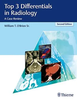 E-Book (epub) Top 3 Differentials in Radiology von William T. O'Brien