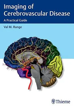 E-Book (epub) Imaging of Cerebrovascular Disease von Val M. Runge