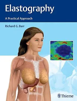 E-Book (epub) Elastography von Richard G. Barr