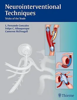 E-Book (epub) Neurointerventional Techniques von Fernando L. Gonzalez, Felipe C. Albuquerque, Cameron G. Mcdougall
