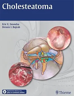 E-Book (epub) Cholesteatoma von Eric E. Smouha, Dennis I. Bojrab