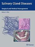 E-Book (epub) Salivary Gland Diseases von 