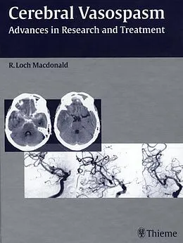 E-Book (epub) Cerebral Vasospasm von R. Loch Macdonald