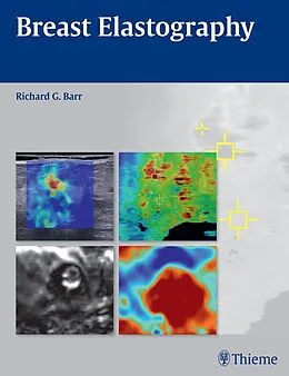 E-Book (epub) Breast Elastography von Richard G. Barr