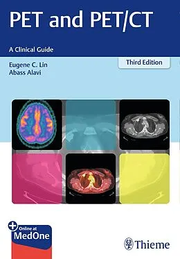 E-Book (epub) PET and PET/CT von Eugene C. Lin, Abass Alavi