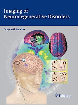 eBook (epub) Imaging of Neurodegenerative Disorders de 