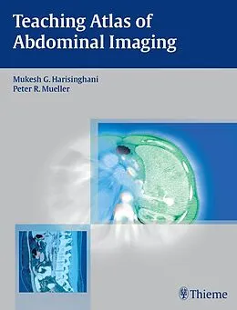 E-Book (epub) Teaching Atlas of Abdominal Imaging von Mukesh G. Harisinghani, Peter R. Mueller