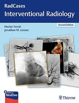 E-Book (epub) RadCases Q&A Interventional Radiology von Hector Ferral, Jonathan M. Lorenz