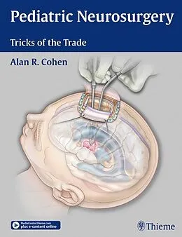 E-Book (epub) Pediatric Neurosurgery: Tricks of the Trade von Alan R. Cohen