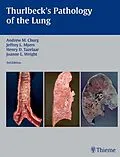 E-Book (epub) Thurlbeck's Pathology of the Lung von Andrew M. Churg, Jeffrey L. Myers, Henry D. Tazelaar