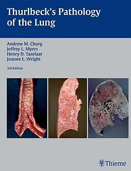 E-Book (epub) Thurlbeck's Pathology of the Lung von Andrew M. Churg, Jeffrey L. Myers, Henry D. Tazelaar