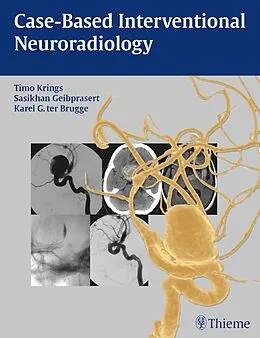 E-Book (epub) Case-Based Interventional Neuroradiology von Timo Krings, Sasikhan Geibprasert, Karel Ter Brugge