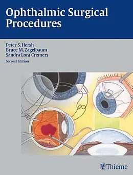 E-Book (epub) Ophthalmic Surgical Procedures von Peter S. Hersh, Bruce Mitchel Zagelbaum, Sandra Lora Cremers