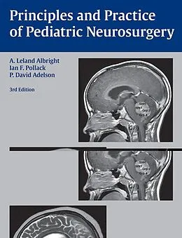 E-Book (epub) Principles and Practice of Pediatric Neurosurgery von A. Leland Albright, Ian F. Pollack, P. David Adelson