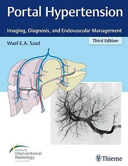E-Book (epub) Portal Hypertension von Wael E. A. Saad