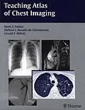 E-Book (epub) Teaching Atlas of Chest Imaging von Mark S. Parker, Melissa L. Rosado-De-Christenson, Gerald F. Abbott