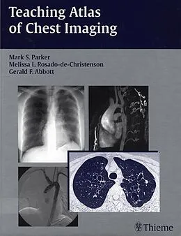 E-Book (epub) Teaching Atlas of Chest Imaging von Mark S. Parker, Melissa L. Rosado-De-Christenson, Gerald F. Abbott