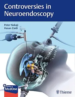 E-Book (epub) Controversies in Neuroendoscopy von Peter Nakaji, Hasan A. Zaidi