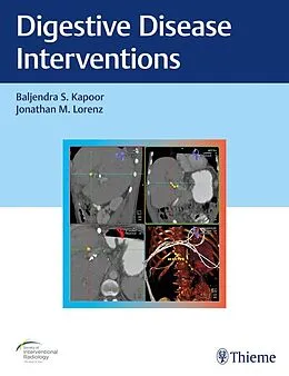 E-Book (epub) Digestive Disease Interventions von Baljendra Kapoor, Jonathan M. Lorenz